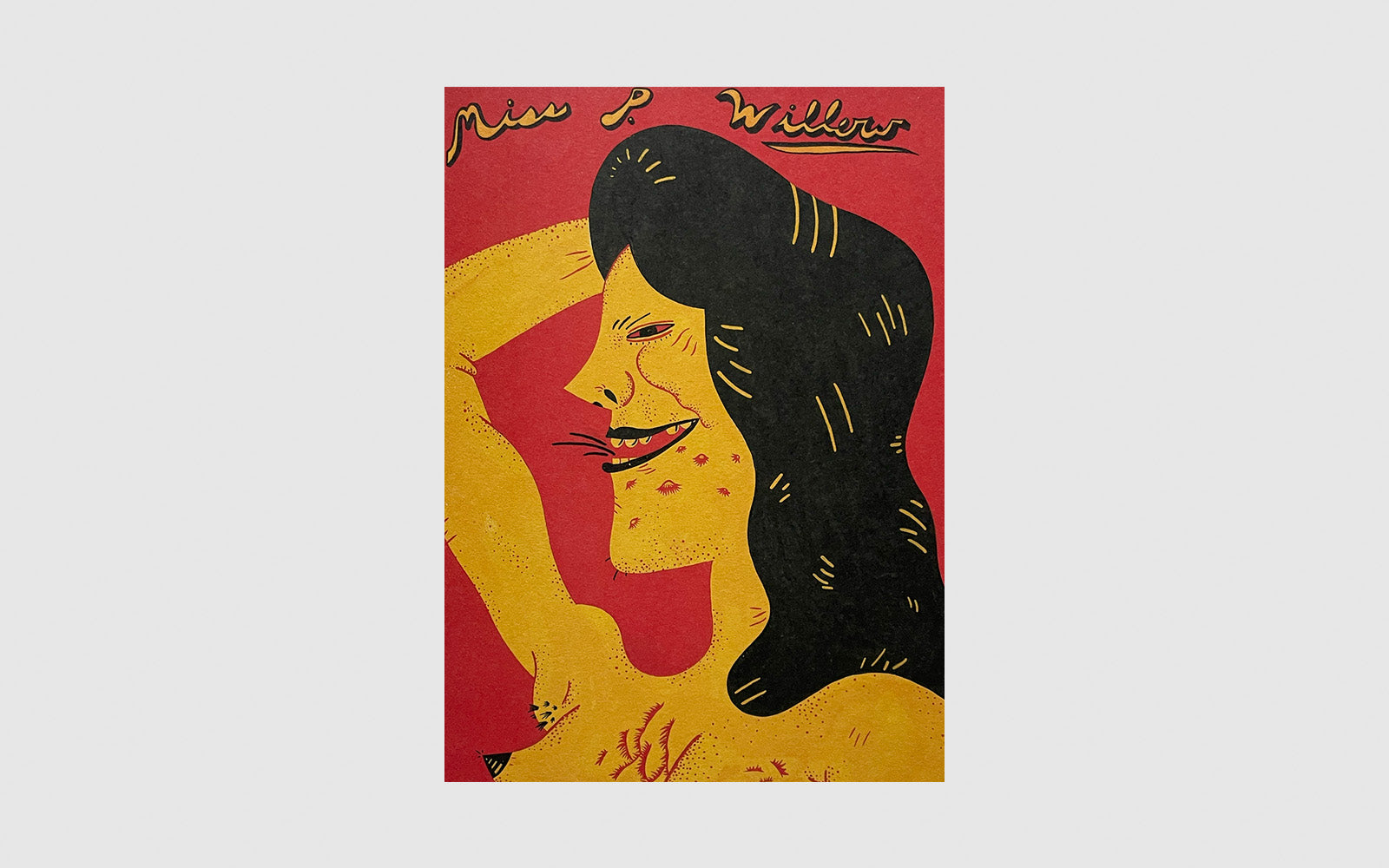 FAW, product: Eye infection (Fig. 7)